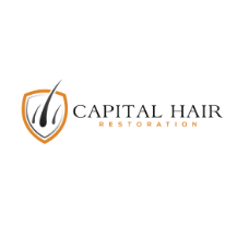 Capital Hair  Restoration 